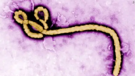 Ebolavirus.jpg Ebolavirus.jpg